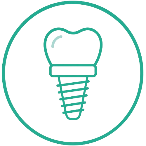 dental mplants