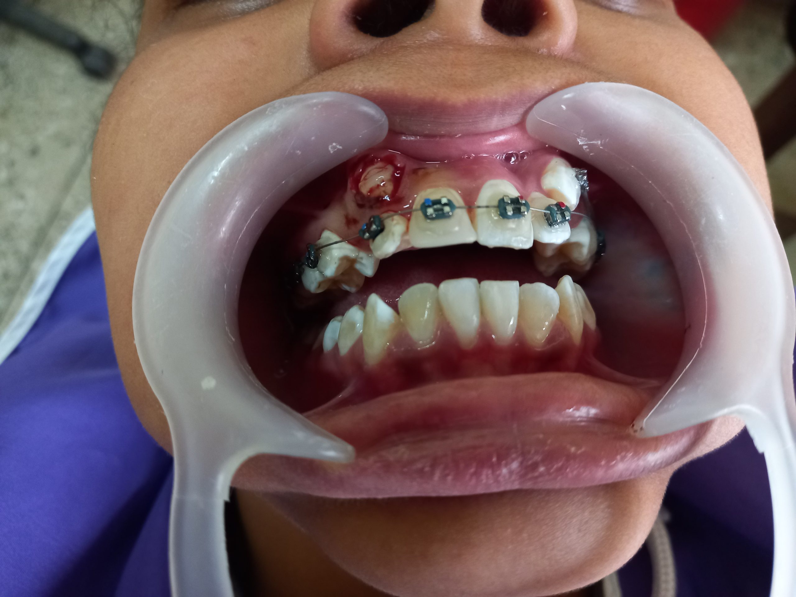 Orthodontics and Dentures Main