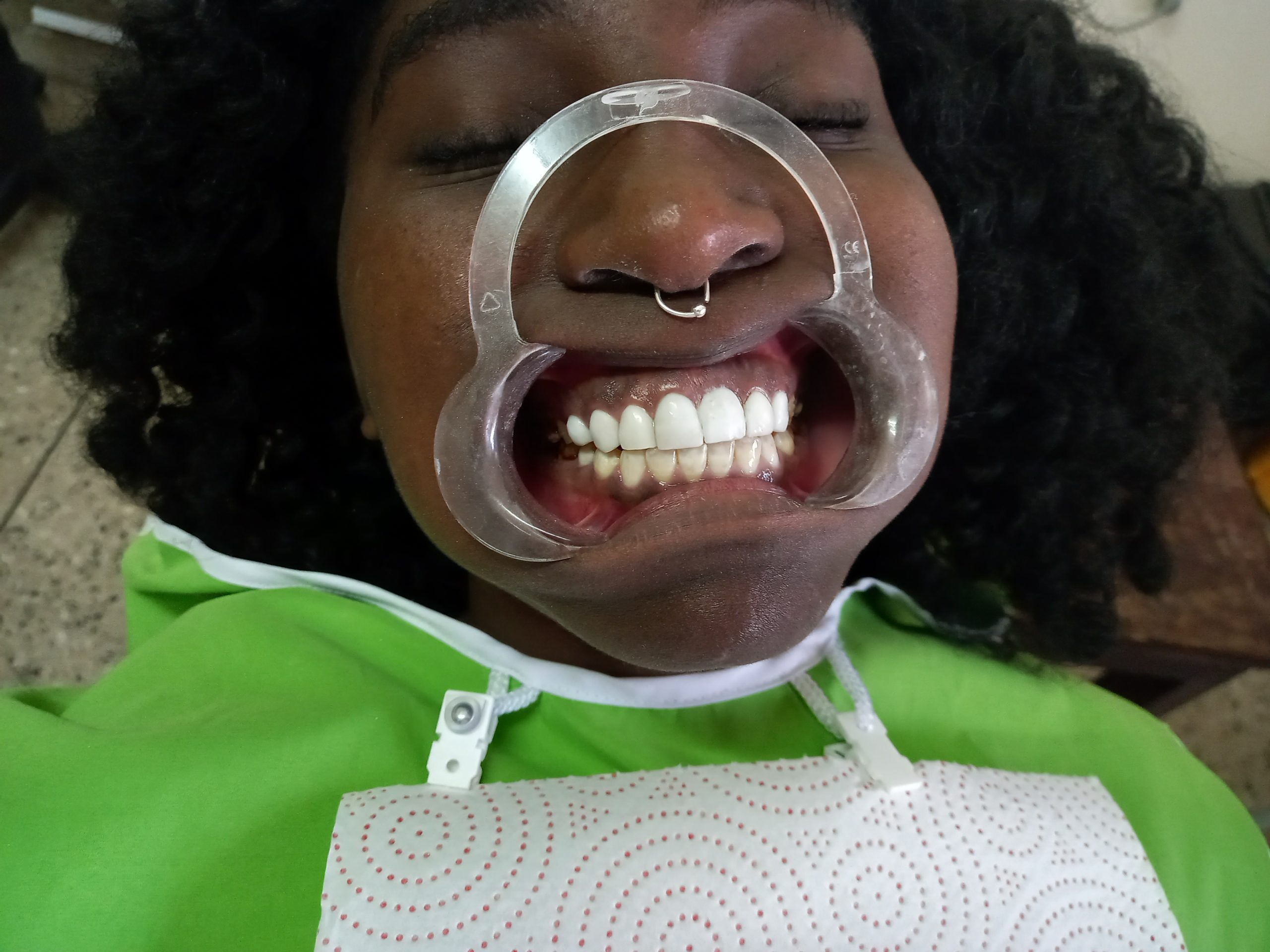 Teeth Whitening & Cosmetic Dentistry